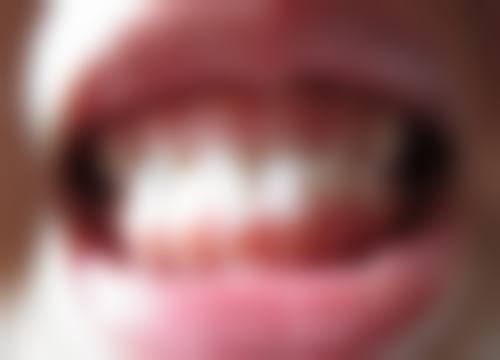 刘宏平的价格收费与就诊指南