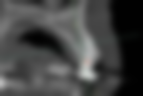 贵州遵义金科口腔门诊部的收费参考标准