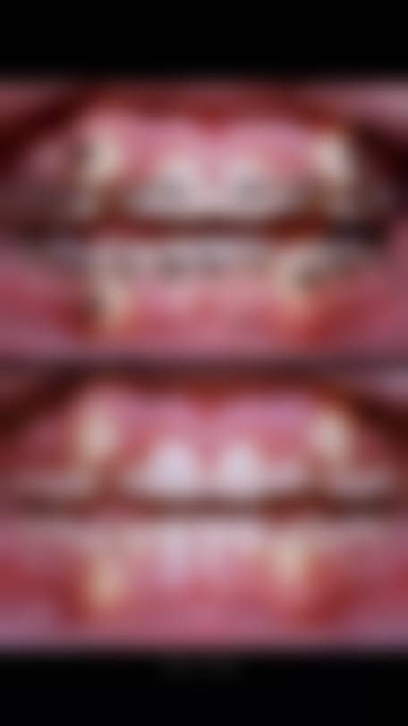 陕西西安商洛东方韵美口腔患者真实评价