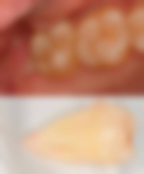 乐东微笑口腔门诊部患者真实评价分享