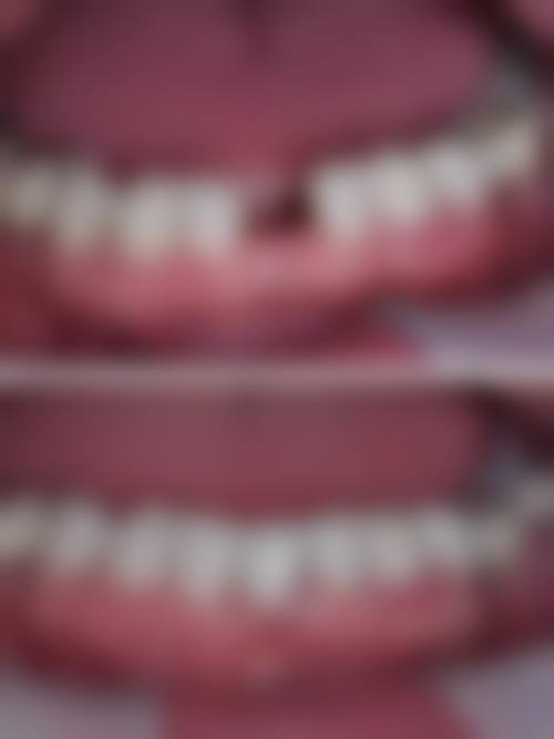 娄宇翔口腔诊所患者真实评价