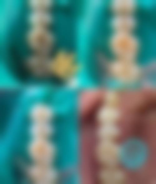 厦门市儿童医院口腔科来院指引