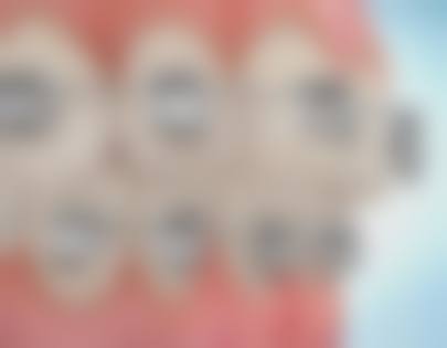 济宁凤华口腔门诊部患者真实反馈