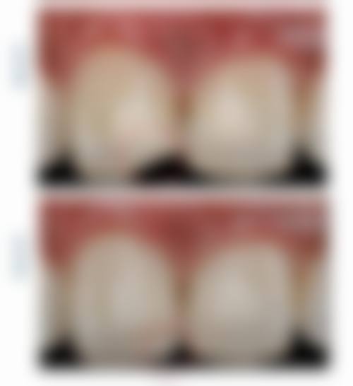 广东肇庆博美口腔诊所患者真实口碑分享