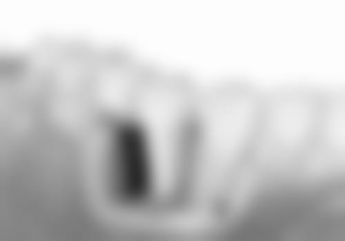 宜昌美立刻口腔（港窑路店）患者真实口碑反馈