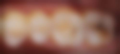 刘宏平的临床实战与个性化方案