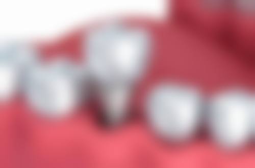 刘秋香 的诊疗标准与服务细节