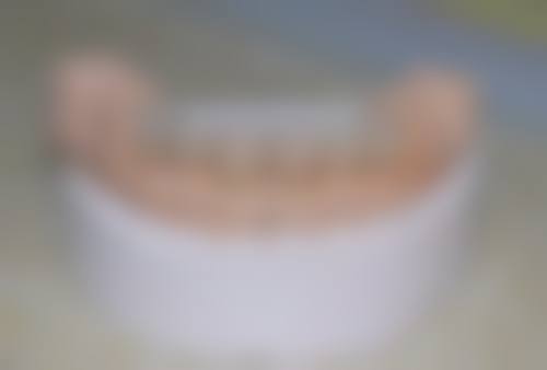 茂名爱牙口腔门诊部收费参考标准