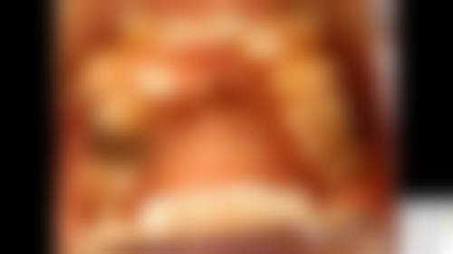 青州李林口腔特色诊疗技术