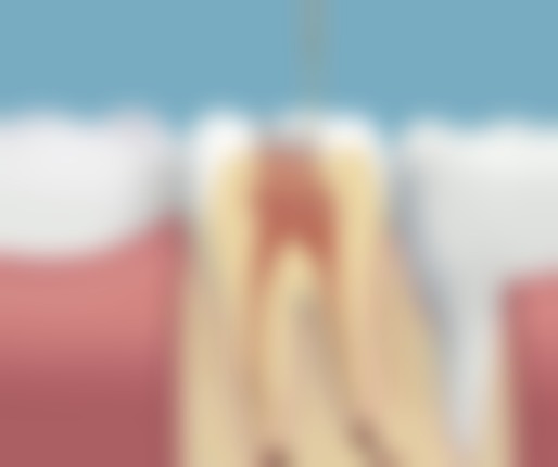 谭军 医生温馨科普：口腔诊疗术前准备指南