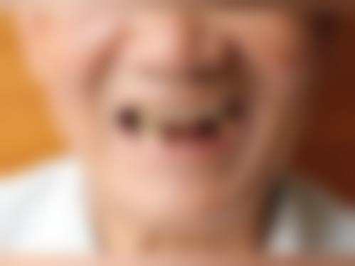 陕西咸阳乾县侯进科口腔特色诊疗项目