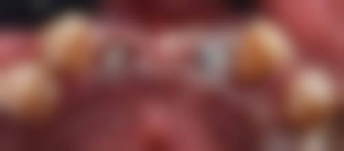 合肥肥东云松口腔门诊部特色诊疗技术