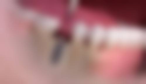 合肥肥东云松口腔门诊部收费价格参考