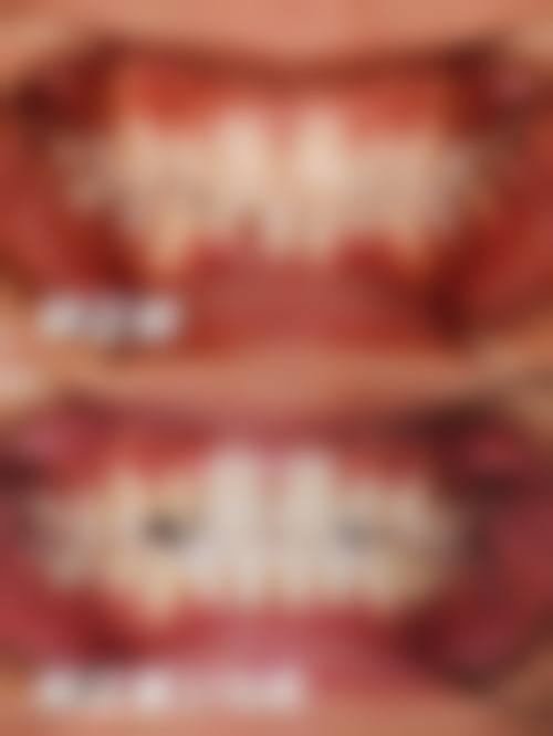 合肥肥东云松口腔门诊部患者真实评价