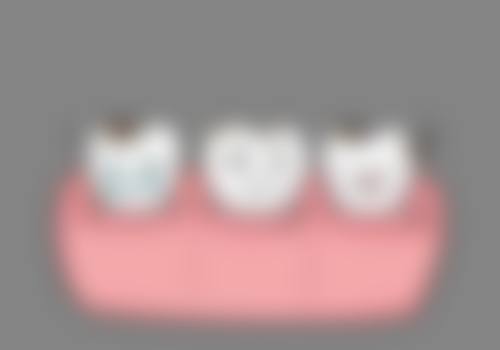 广州陈建明口腔就诊指南