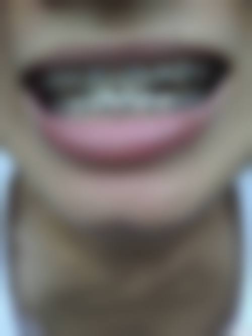 李景媛的临床实战与个性化诊疗