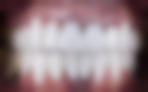 广州陈建明口腔正规资质保护