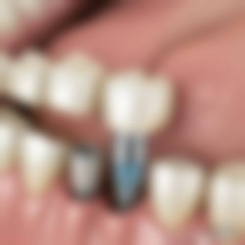 松潘县和平口腔诊所收费标准