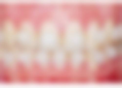 松潘县和平口腔诊所患者真实评价