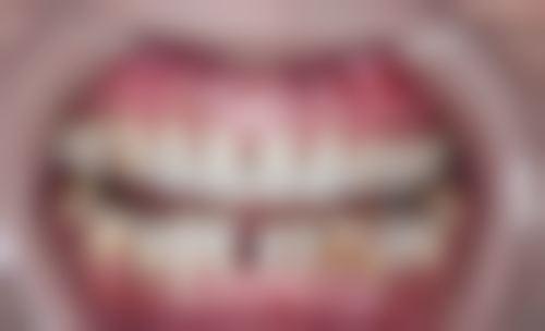 北京斯迈尔口腔医院诊疗项目介绍