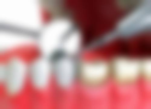 盐池县众康口腔诊所收费价格说明