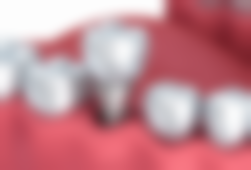 内蒙古呼伦贝尔牙克石徐贺臣口腔诊所患者真实评价