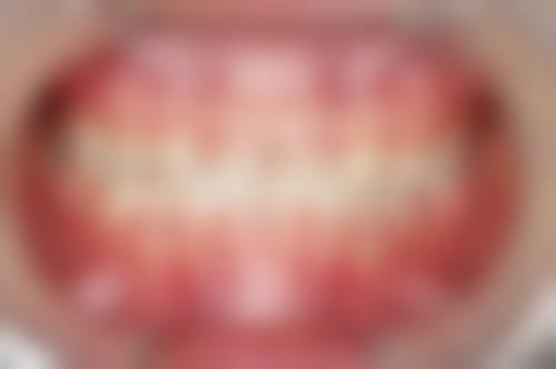 杨彬杰的临床实战与个性化诊疗