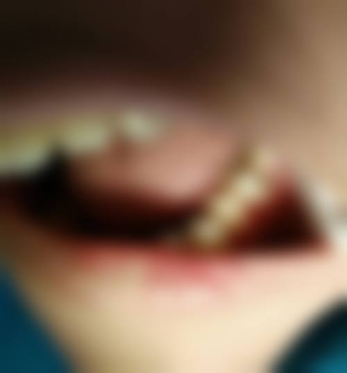 长沙贝洁口腔门诊部收费价格参考