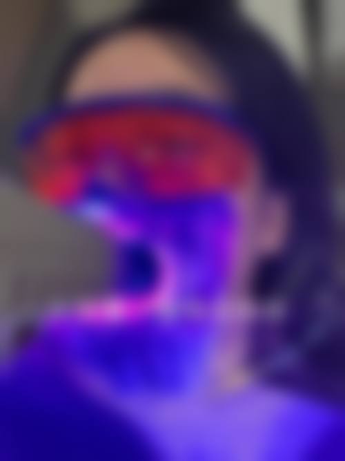 广州维密欧贝丽口腔特色诊疗技术