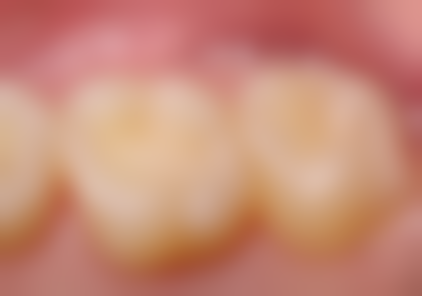 桂林廖宏荣口腔技术设备优势