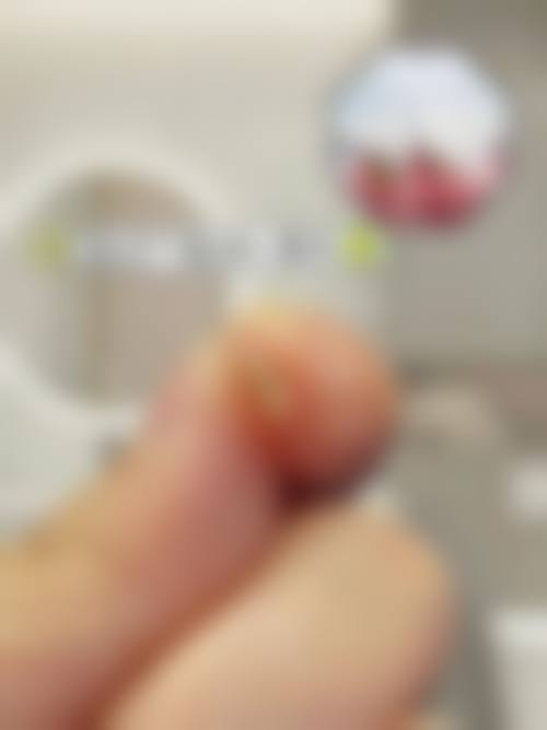 王思兴的临床实战与个性化诊疗