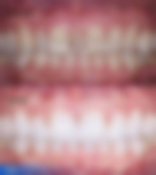 浙江省中医院湖滨院区口腔科设备与技术优势