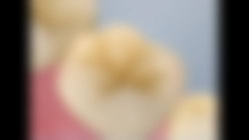 大同恒大口腔收费参考标准