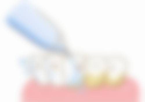 昭阳柯品牙管家口腔门诊部患者真实评价