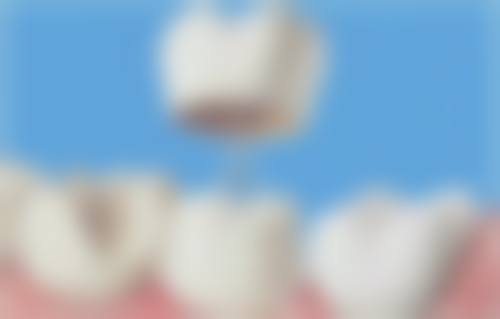 重庆江津启辰口腔医院患者真实反馈