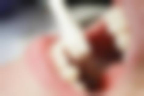 贾保军的临床实战与个性化诊疗