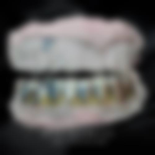 四会维美口腔门诊部患者真实评价