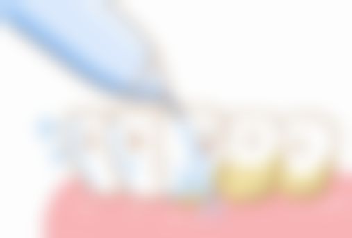 广东东莞丽城口腔特色诊疗技术