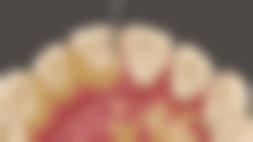深圳永乐口腔诊所来院指引