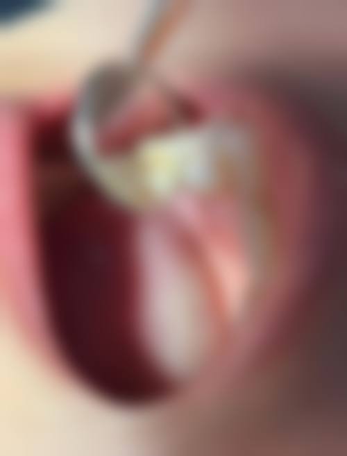 无锡张华兵口腔诊所特色诊疗技术