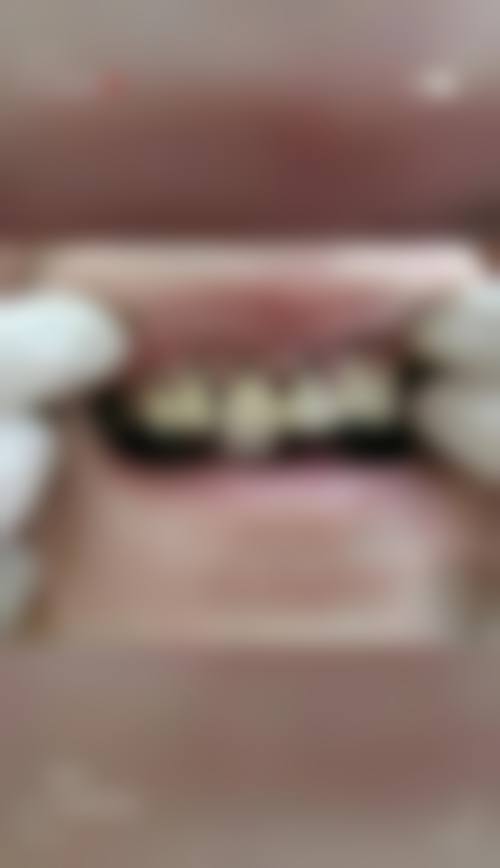 李柠的价格与坐诊指引