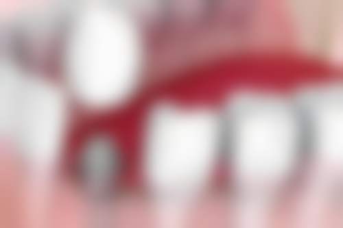 深圳南园口腔门诊部收费标准参考