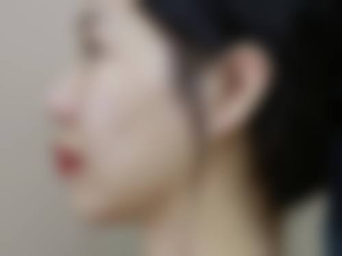 荆州美奥口腔医院合理收费标准