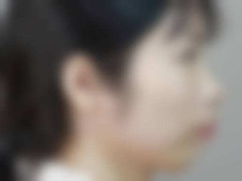 杨彬杰的临床实战与个性化诊疗