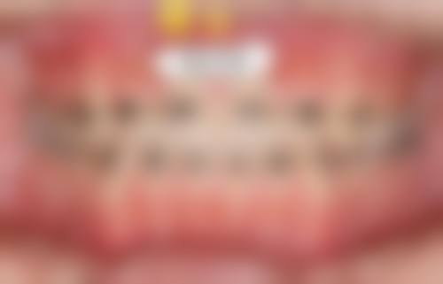 广东广州迎康口腔患者真实评价