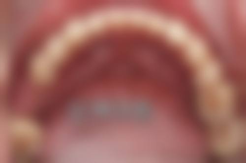 榆林红涛口腔正规资质保护