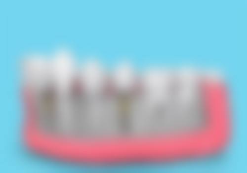 乌鲁木齐刘爱珍口腔特色诊疗技术