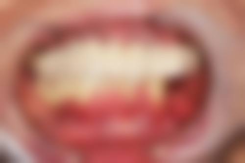 北海杨细莲口腔诊所特色技术优势