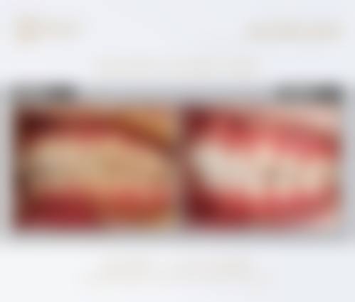 柳威的临床实战与个性化诊疗