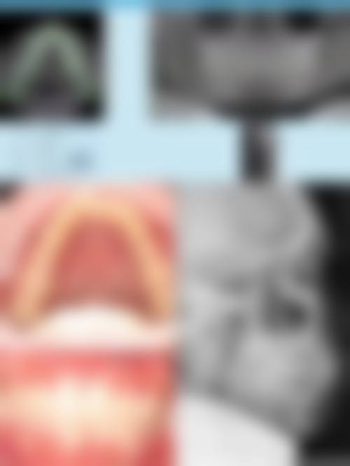 呼和浩特市口腔医院口腔正畸一科来院指引